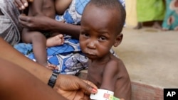 FILE- A doctor attends to a malnourished child at a refugee camp in Yola, Nigeria. May 3, 2015.