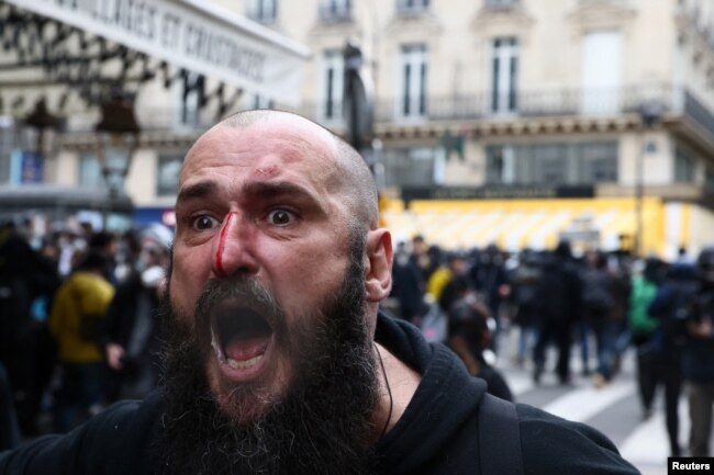 An injured man reacts during a demonstration as part of the ninth day of nationwide strikes and protests against French government's pension reform, in Paris, March 23, 2023.