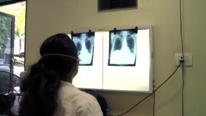 Veći broj slučajeva tuberkuloze, ali manje umrlih