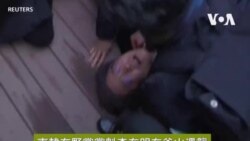 南韓在野黨黨魁李在明在釜山遇襲 尹錫悅：絕不容忍暴力行為