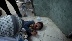 A Palestinian child wounded in the Israeli bombardment of the Gaza Strip is brought to Al Najjar hospital in Rafah, Gaza Strip, Feb. 24, 2024. Israel's war cabinet agreed Saturday to send negotiators to Qatar to continue talks toward a cease-fire, officials and media said. 