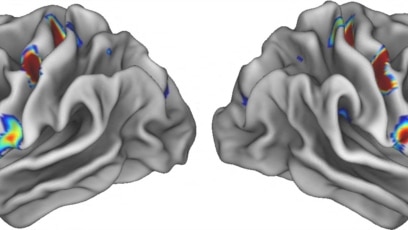 Researchers: Two Separate Systems Control Human Movements