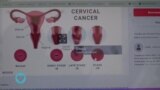 Jamii ina uelewa kiasi gani kuhusu saratani ya shingo ya Kizazi au Cervical Cancer?