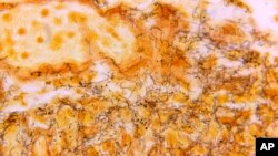 FILE - This 1966 microscope photo made available by the Centers for Disease Control and Prevention shows a tissue sample with numerous, corkscrew-shaped, darkly-stained Treponema pallidum spirochetes, the bacterium responsible for causing syphilis. 