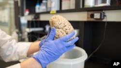 In this July 29, 2013 photo, a researcher holds a human brain in a laboratory at Northwestern University's cognitive neurology and Alzheimer's disease center in Chicago. (AP Photo/Scott Eisen)