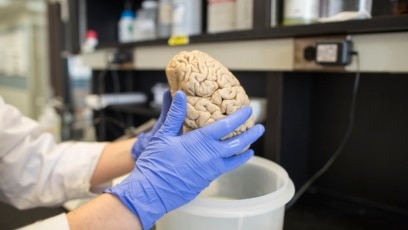 Scientists Create ‘Biocomputer’ with Lab-Grown Brain Tissue