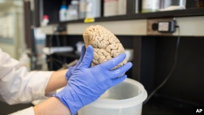 First almost fully-formed human brain grown in lab, researchers claim, Neuroscience