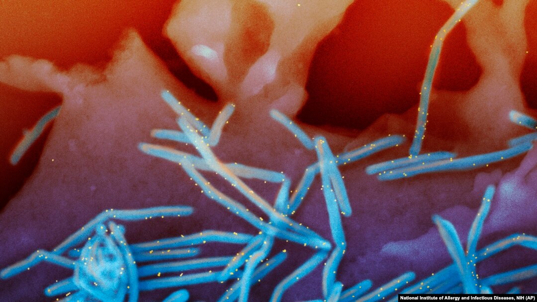 Gambar dari virus pernafasan syncytial (RSV), yang berwarna biru, dan anti-RSV F protein atau dikenal dengan antibodi emas, yang berwarna kuning. (Foto: National Institute of Allergy and Infectious Diseases, NIH via AP)