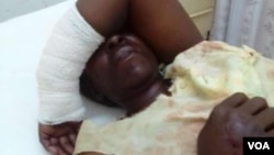 Ms Tholiwe Moyo was attacked by a crocodile while crossing Kana River