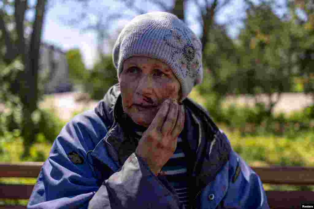 A wounded woman sits outside a train station hit by a Russian military strike, amid Russia's attack on Ukraine, in Kherson, Ukraine.