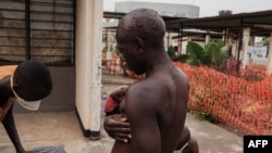 Le premier cas de mpox détecté au Gabon concerne un homme de 30 ans. (photo d'illustration)