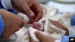 This photo released by the Berlin Zoo shows employees measuring two newborn giant pandas on Aug. 22, 2024. 