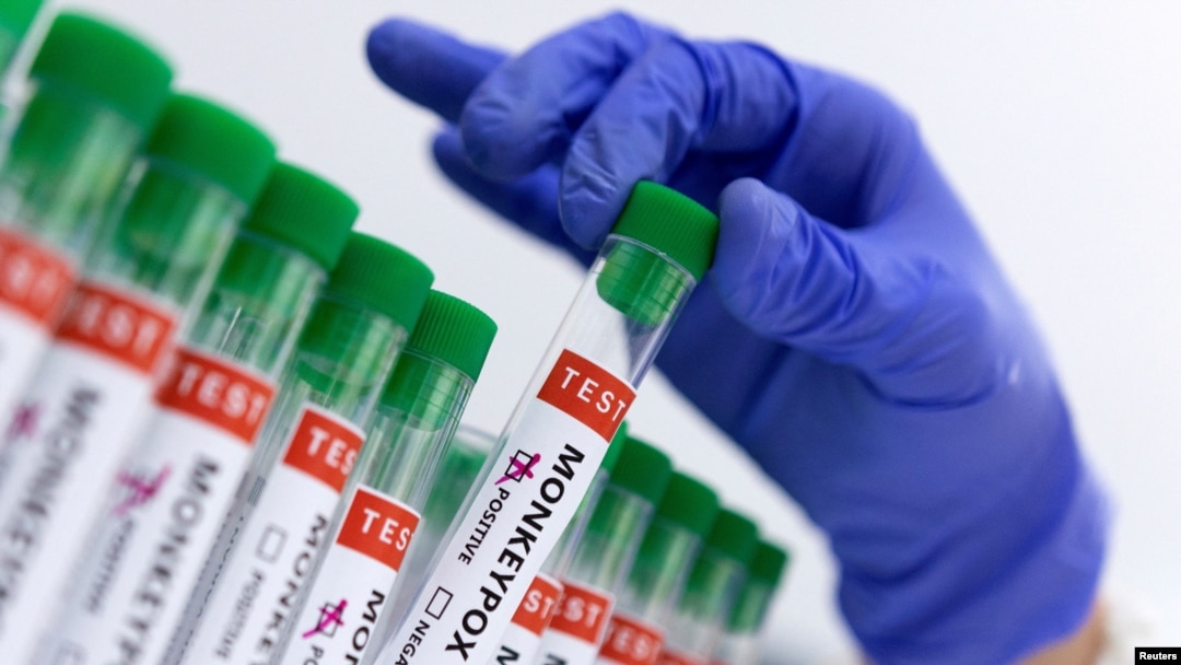Tabung reaksi berlabel "Virus cacar monyet positif dan negatif" terlihat dalam ilustrasi yang diambil pada 23 Mei 2022. (Foto: REUTERS/Dado Ruvic)