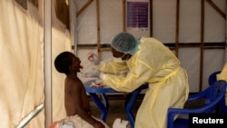 FILE - A laboratory nurse takes a sample from a child suspected of being infected with mpox at a treatment center in Munigi, near Goma, North Kivu province, Democratic Republic of Congo, July 19, 2024. 