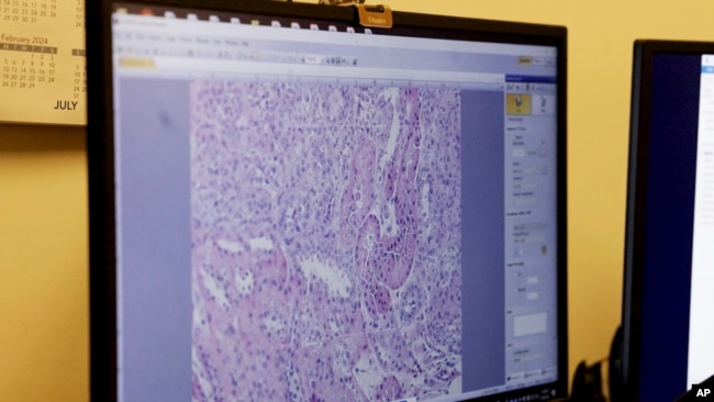 Researchers at NYU Langone Health examine cells from a pig kidney biopsy after the transplant of the pig's kidney into a brain-dead man in New York on July 28, 2023. (AP Photo/Shelby Lum)