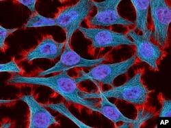 FILE - This undated microscope image made available by the National Center for Microscopy and Imaging Research shows HeLa cells.