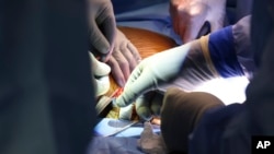 2024年3月16日，外科医生在波士顿麻省总医院进行了世界上首例转基因猪肾移植到活体人体中的手术。（美联社照片/麻省总医院提供）