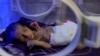 ILUSTRASI - Seorang bayi yang lahir prematur terbaring di dalam inkubator di unit perawatan intensif neonatal di rumah sakit al-Thawra di ibu kota Yaman, Sanaa pada 24 Maret 2021. (Mohammed HUWAIS / AFP)