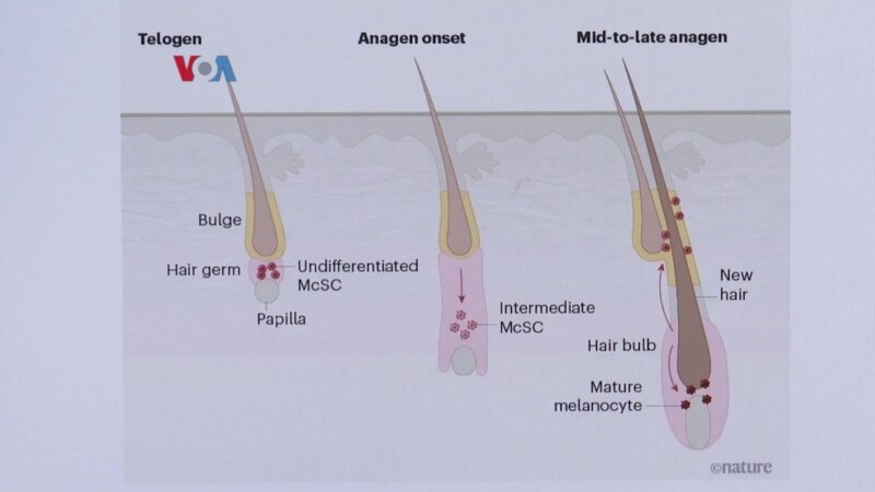 Peneliti Temukan Alasan Ilmiah Penyebab Rambut Beruban