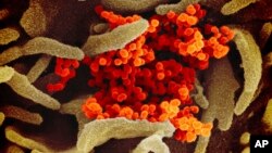 This image provided by The National Institute of Allergy and Infectious Diseases shows the SARS-CoV-2 virus. (NIAID-RML via AP)