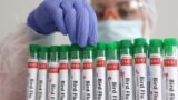 FILE - Test tubes labelled 'Bird Flu", are seen in this picture illustration, Jan. 14, 2023. 