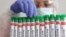 FILE - Test tubes labelled 'Bird Flu", are seen in this picture illustration, Jan. 14, 2023. 