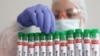 Argentina Laporkan Kasus Baru Flu Burung  