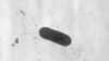 FILE - This 2002 electron microscope image made available by the Centers for Disease Control and Prevention shows a Listeria monocytogenes bacterium, responsible for the food borne illness listeriosis.