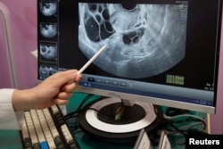 Li Yi-ping, chief director of the reproduction medical centre, points to a screen displaying Vivian Tung's ovarian follicles during a regular check-up at the Shin Kong Wu Ho-Su Memorial Hospital in Taipei, Taiwan, June 17, 2023. (REUTERS/Ann Wang)