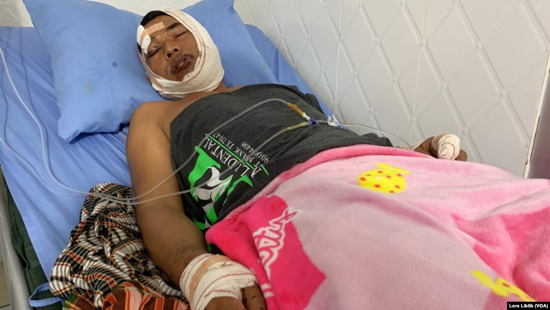 ភរិយា​របស់​លោក នី ណាក់ អំពាវនាវ​ចាប់​ជន​ដៃ​ដល់  ក្រោយ​ស្វាមី​ត្រូវ​បាន​វាយ​​យ៉ាង​ដំណំ