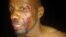 Omunye wabebandla le CCC othi watshaywa ngabasekeli bebandla le Zanu PF eMuguza.
