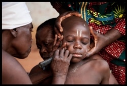 Séance de scarification d'un enfant.