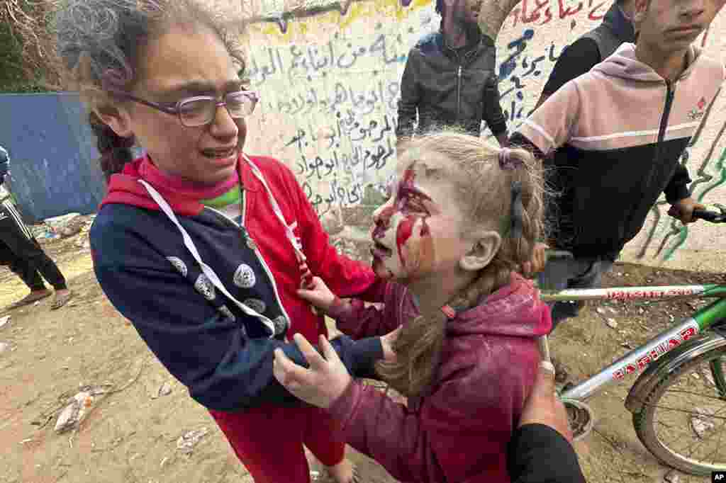 A wounded Palestinian girl is helped after an Israeli strike on Al Zawayda, central Gaza Strip.