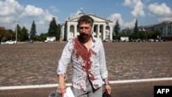 An injured man walks off the site of a missile strike near the Taras Shevchenko Chernihiv Regional Academic Music and Drama Theatre in Chernihiv, Ukraine, Aug. 19, 2023. 