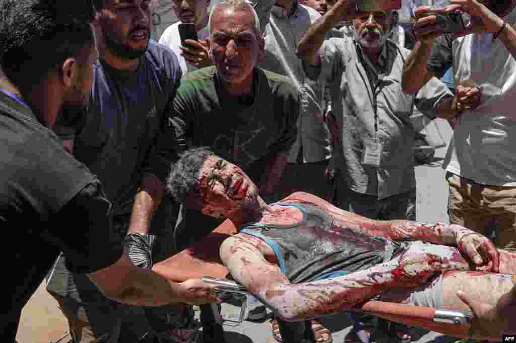 An injured youth is brought to the Al-Aqsa Martyrs Hospital in Deir al-Balah, after the Israeli bombardment of agricultural land in the area of al-Maghazi in the central Gaza Strip.