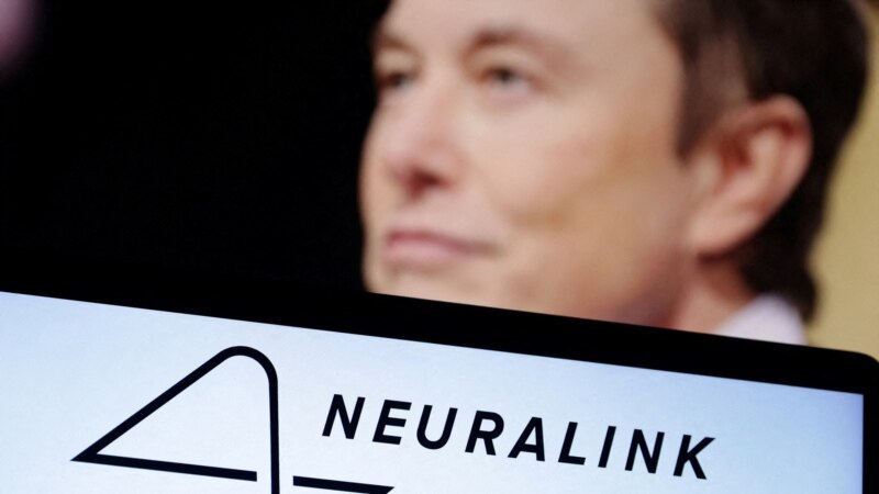 Musk's Neuralink to Start Human Trial of Brain Implant ...