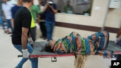 Palestinian wounded in Israeli bombardment is brought to a hospital in Deir Al-Balah, south of the Gaza Strip, Oct. 25, 2023. 