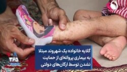 گلایه خانواده یک شهروند مبتلا به بیماری پروانه‌ای از حمایت نشدن توسط ارگان‌های دولتی 