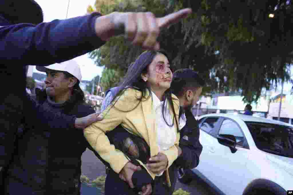 An injured woman is carried away after presidential candidate Fernando Villavicencio was shot to death while at a campaign rally outside a school in Quito, Ecuador, Aug. 9, 2023.