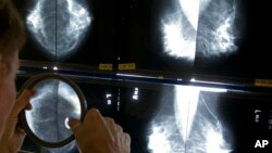 Foto Achiv: Yo radiyolojis gade de pre mamogram pou detekte kanse nan sen nan Los Angeles, 6 Me, 2010. 