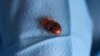 FILE - A bed bug is seen on a glove of a biocide technician from the company Hygiene Premium in L'Hay-les-Roses, near Paris, France, Sept. 29, 2023.