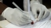 FILE - A doctor registers blood after testing a patient at a local government hospital in Harare, Zimbabwe, Feb. 4, 2020