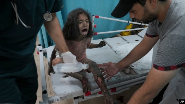 Palestinian child wounded in Israeli bombardment is treated in a hospital in Deir al Balah, south of the Gaza Strip, Oct.27, 2023.