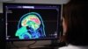 科学家使用脑部扫描和人工智能来“解码”人类思想