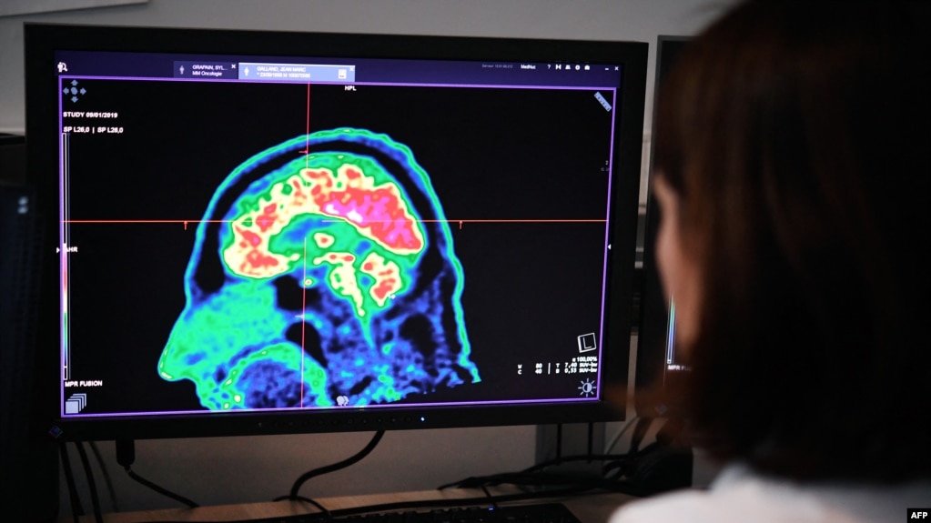 资料照片：2019年1月9日，在法国西部布雷斯特地区和大学医院中心的屏幕上可以看到由正电子发射断层扫描扫仪拍摄的人脑图片。（法新社照片）(photo:VOA)