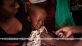 Dinye sumayabana don seli kadri kono, Makriam Kouyate ni Dr Vincent Sangogo barola, Mali sumayabana keleli siratigiw kan.