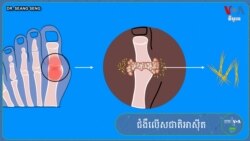 Hello VOA សុខភាព៖ ជំងឺ​លើស​ជាតិ​អាស៊ីត​អាច​សម្ងំ​នៅ​ក្នុង​ខ្លួន​យើង​រាប់​ឆ្នាំ​ទម្រាំ​ដឹង​ថា​មាន​ជំងឺ​នេះ