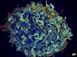 FILE - This electron microscope image made available by the U.S. National Institutes of Health shows a human T cell, in blue, under attack by HIV, in yellow, the virus that causes AIDS.