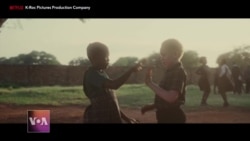 Zambian Film Focuses on Hardships Faced by Boy With Albinism.