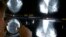 FILE - A radiologist uses a magnifying glass to check mammograms for breast cancer in Los Angeles, May 6, 2010. 